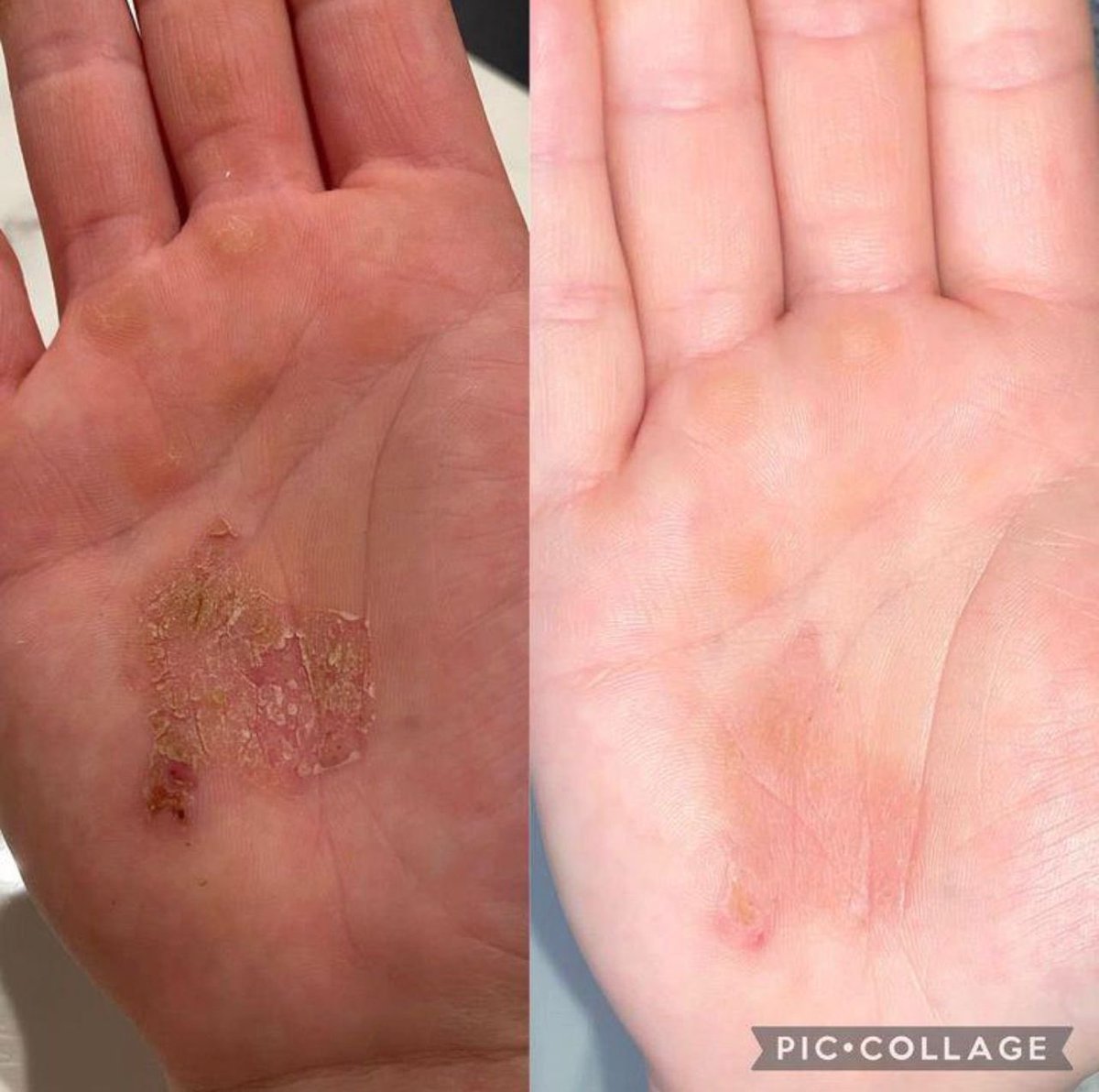 To the daft comments,  RESULTS SPEAK FOR THEMSELVES and that was in less than a week