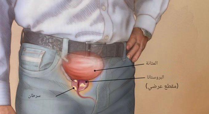 يعاني العديد من الشباب بالفعل من مشاكل في البروستاتا ولكنهم لا يعرفون ذلك. سأخبرك ببعض العلامات والأعراض التي قد تتوقعها لمساعدتك على اتخاذ الإجراءات اللازمة.💔

من فضلك لا تأخذ هذه المعلومات على محمل الجد.🙏🧵