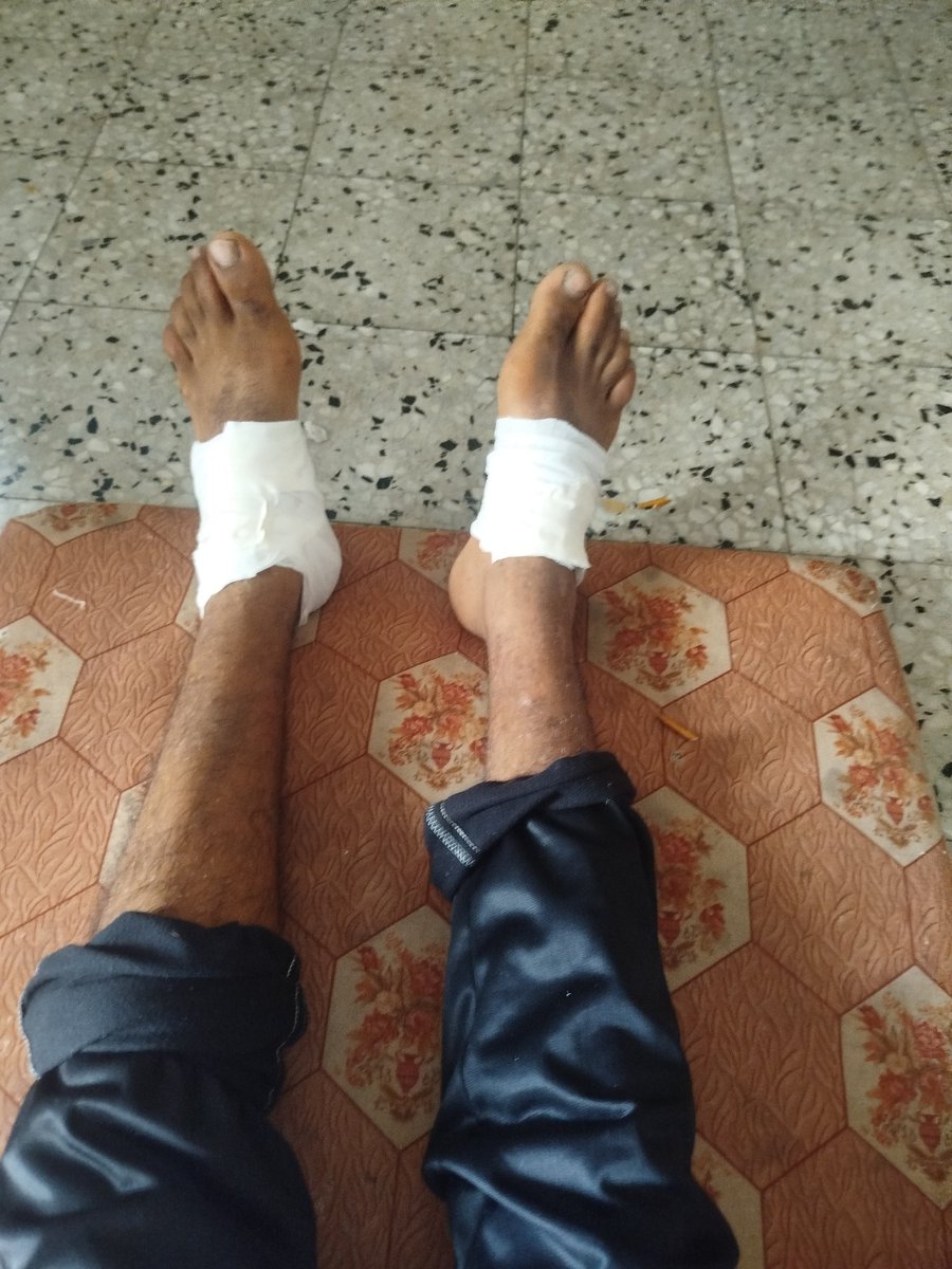 My husband was injured. He went to get food, but he was shot. 
I beg you to donate to us, we need medicine and food 
chuffed.org/project/help-n…