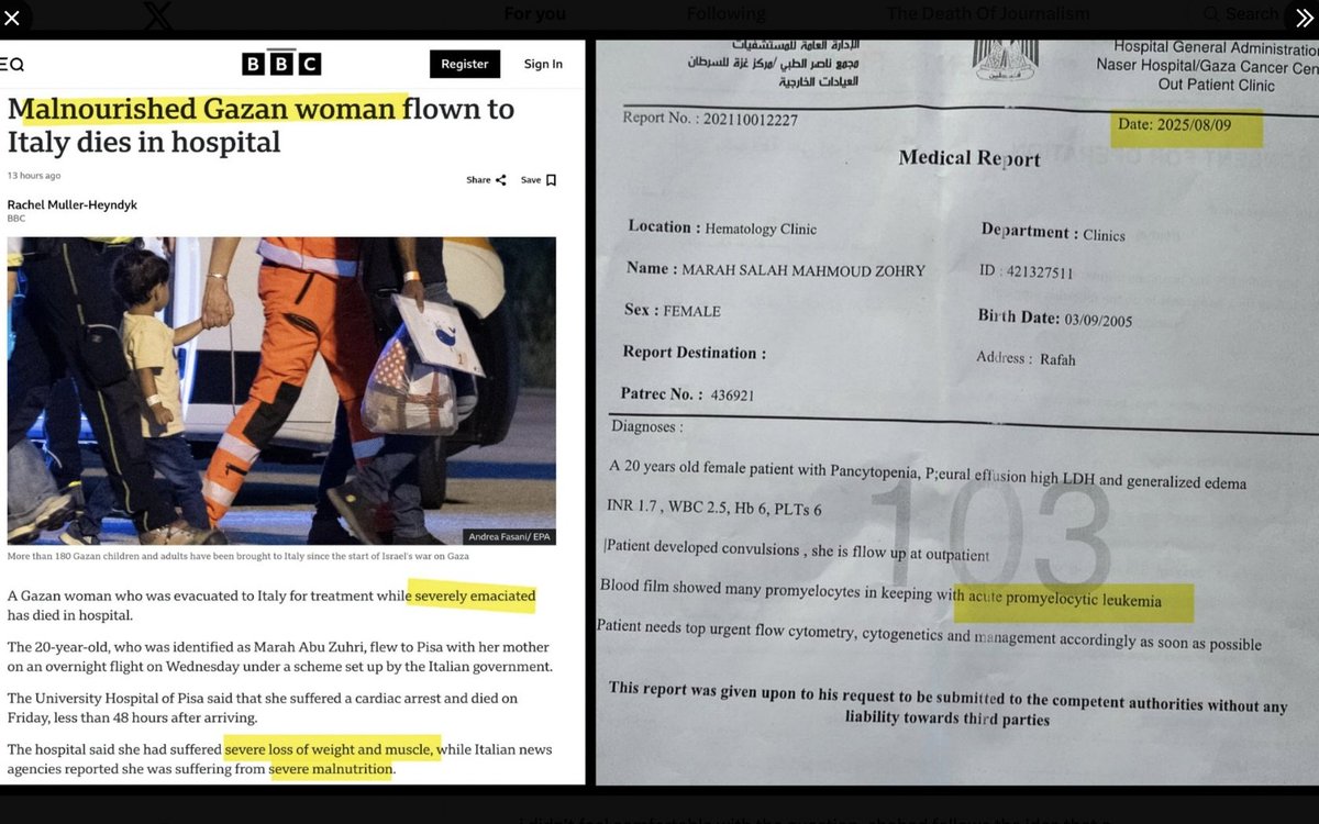 usil2tryit's tweet image. #TalHartuv
Reality: Israel flew a Gaza woman to Italy to try to save her life.

Hospital report: She died of leukemia

BBC News: Genocidal Jews starve a Gazan woman to death.

If you're in the UK, cancel your TV license.

#BBC BBC World Service @BBCWorld @BBCBreaking