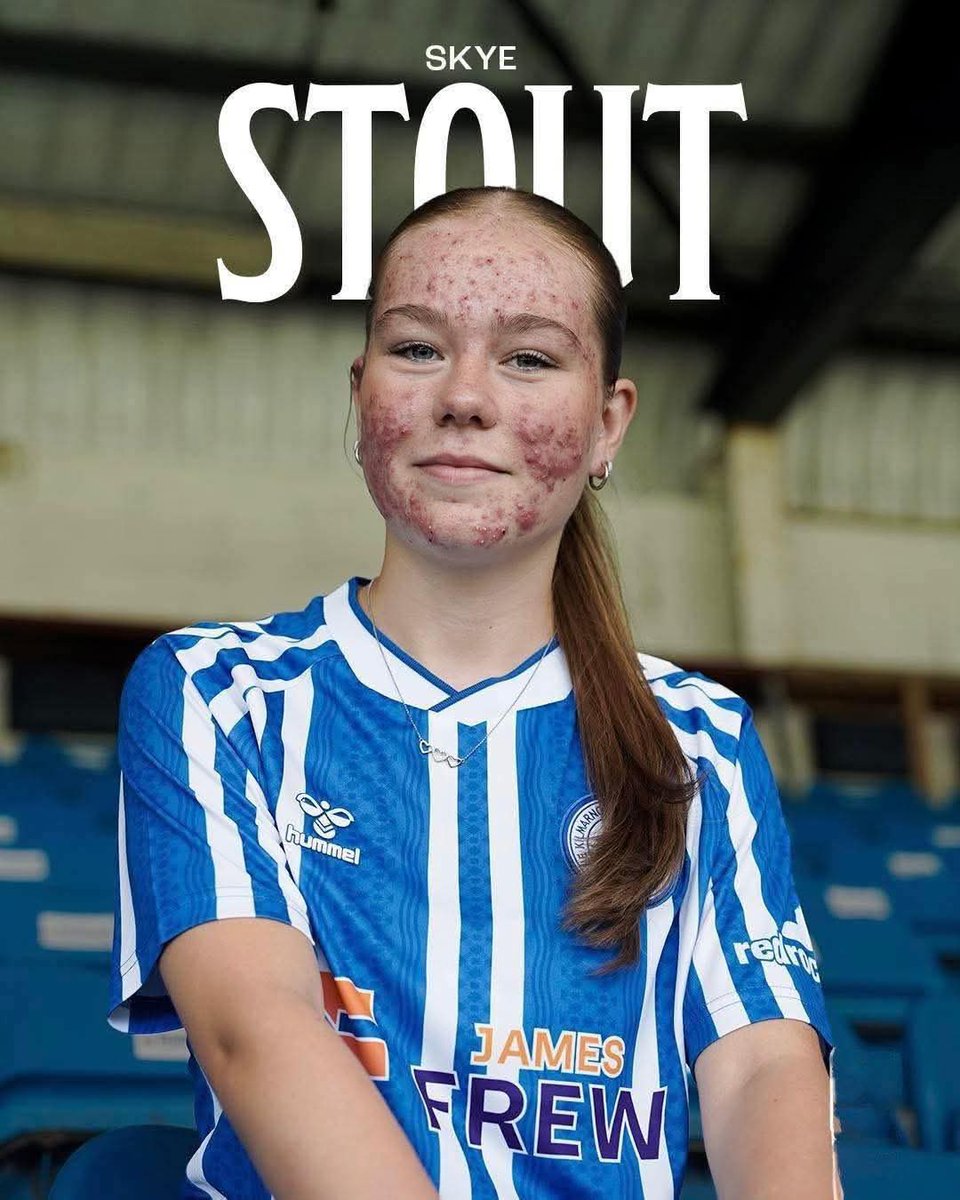 16-year-old Skye Stout faced online abuse over her appearance after joining Kilmarnock Women, forcing the club to delete the announcement. She answered with a stunning free-kick goal and an assist in her debut against St Johnstone. 

Across the UK, #WeStandWithSkye is trending —