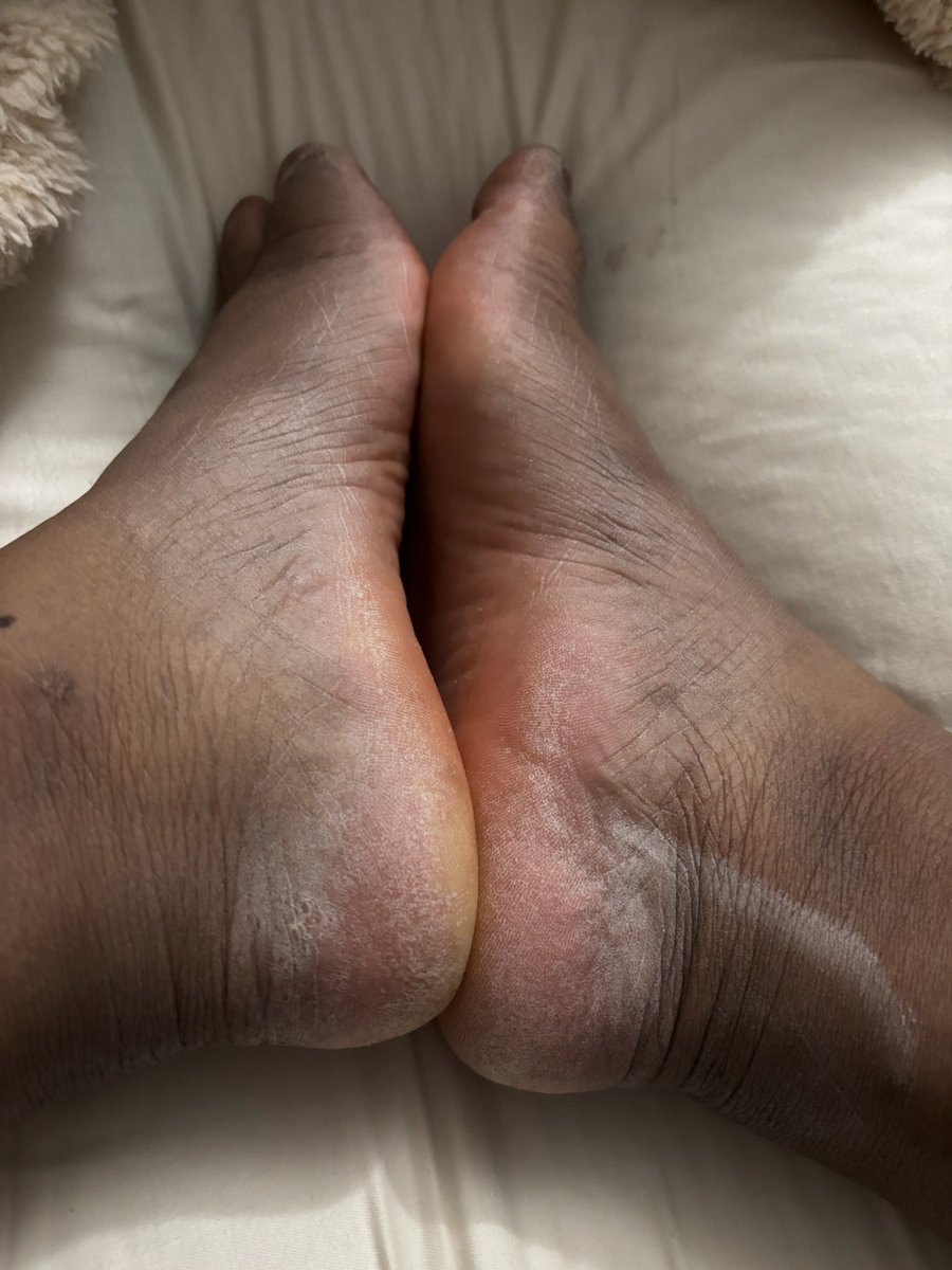 MrLoveClub Model: Tatum
Size: 10
Stench: 8/10 (vinegar)

Full Video &amp; Photoset on mrloveoffeet.com