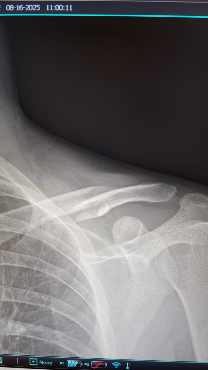 Winky (@winkyhc) on Twitter photo Pain. Guess we gaming with 1 arm for a while Pain. Guess we gaming with 1 arm for a while
