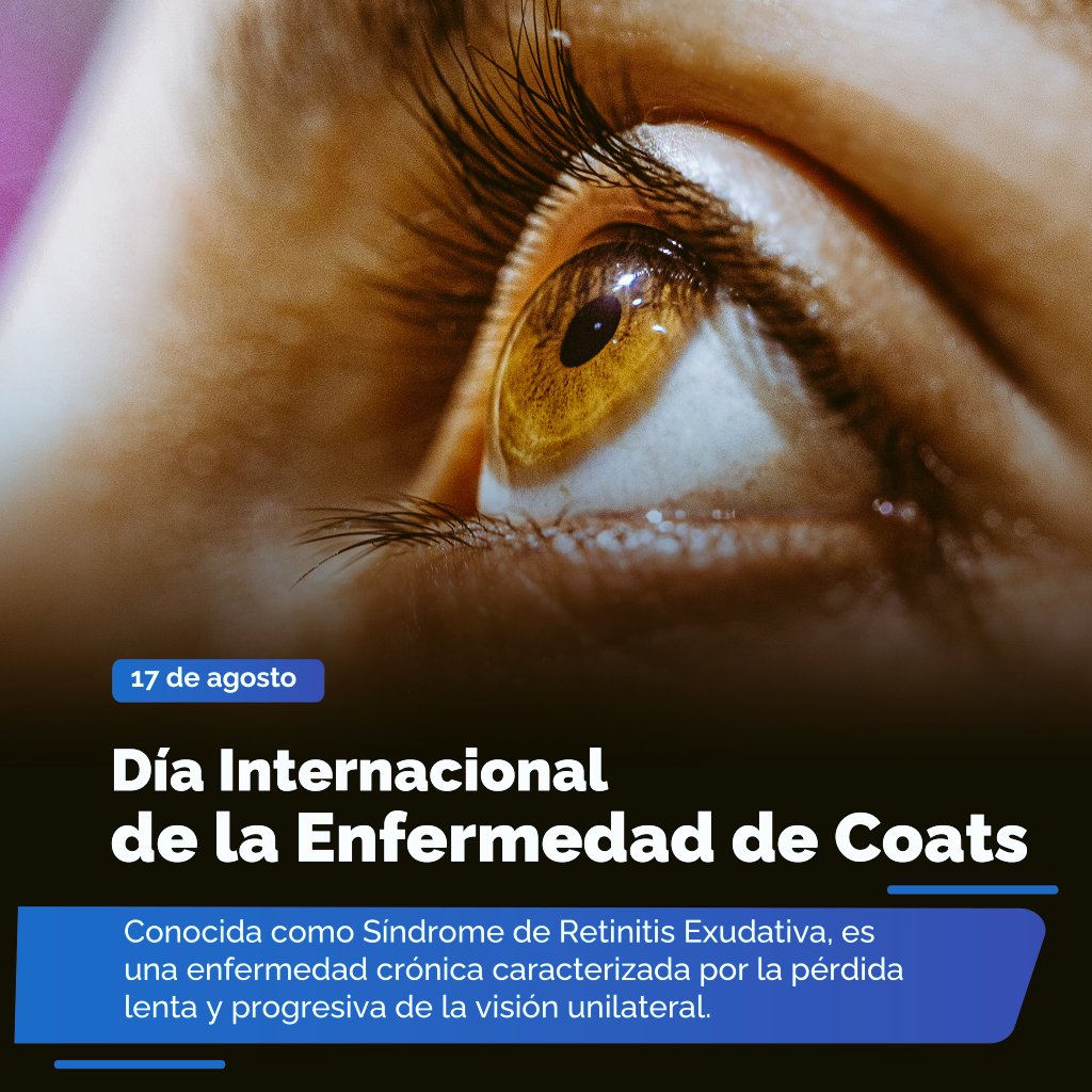 #Efemérides #17Ago Día Internacional de la Enfermedad de Coats 👁️, caracterizada por la pérdida lenta y progresiva de la visión unilateral.