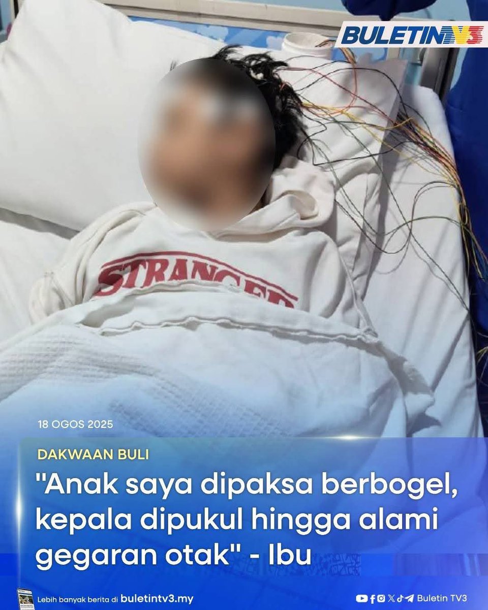 Seorang murid lelaki berusia 10 tahun yang juga pesakit kanser hidung, kini menderita akibat gegaran otak selepas didakwa menjadi mangsa buli di sebuah sekolah agama, Johor Bahru, Februari lalu.