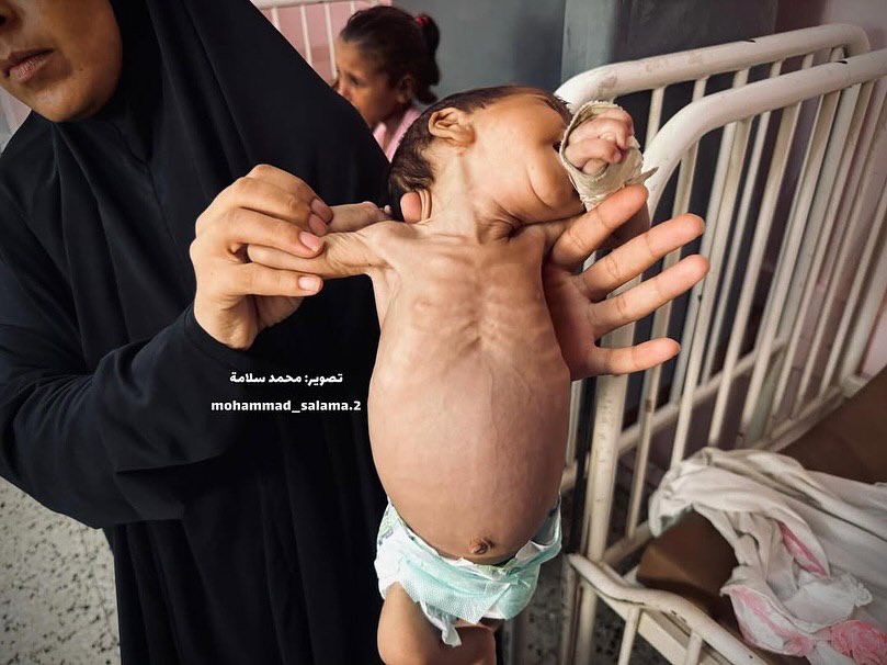 EyeonPalestine's tweet photo. Urgent Appeal | Baby Raseel Khaled Abu Masoud, just 2 months old and weighing only 5.5 lbs, suffers from severe weakness and urgently needs medical care and proper nutrition. Her family pleads for immediate intervention before her condition worsens.
Contact: +970595291130 / +972

الطفلة راسيل خالد أبو مسعود (عمرها شهران ووزنها 2.5 كغ) تعيش أوضاعًا صحية ومعيشية صعبة، حيث تعاني من ضعف جسدي وحاجة ماسة
للرعاية الطبية والغذاء اللازم.
عائلتها تناشد أهل الخير والمؤسسات الإنسانية سرعة التدخل لإنقاذها قبل
تفاقم حالتها.