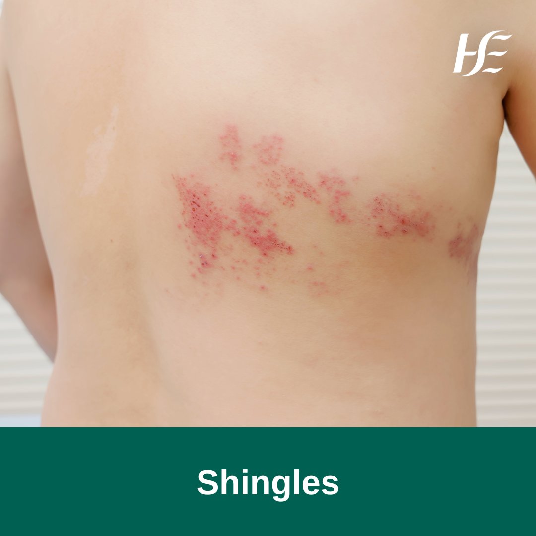 HSE Ireland tweet media