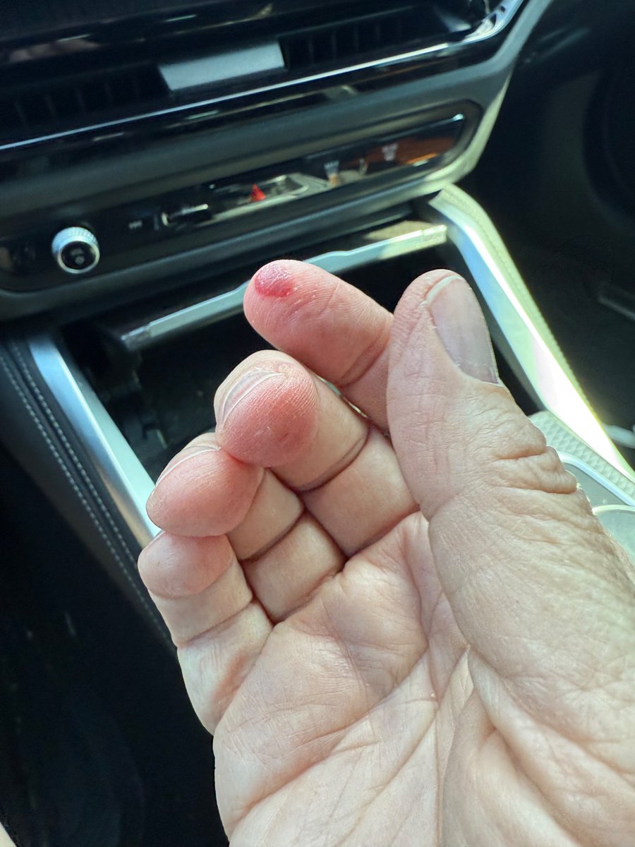 leils's tweet photo. #docswhorock
I might have overdone it…. https://t.co/yqzVN39Ccz