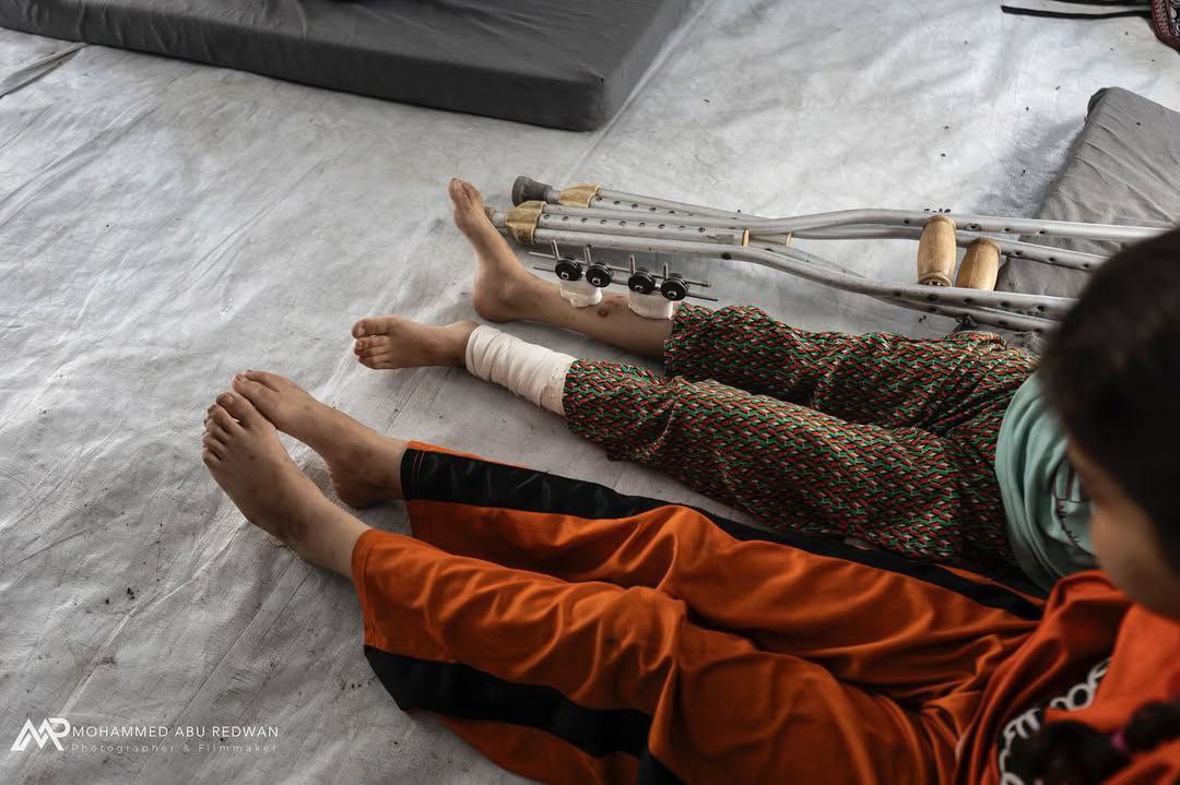 #Photos | Les deux seules survivantes du massacre ayant visé leur maison : les sœurs Maria et Sondos Rayhan.
Maria a perdu la vue, tandis que Sondos souffre d’une grave blessure à la jambe, après que le reste de leur famille a été décimé.