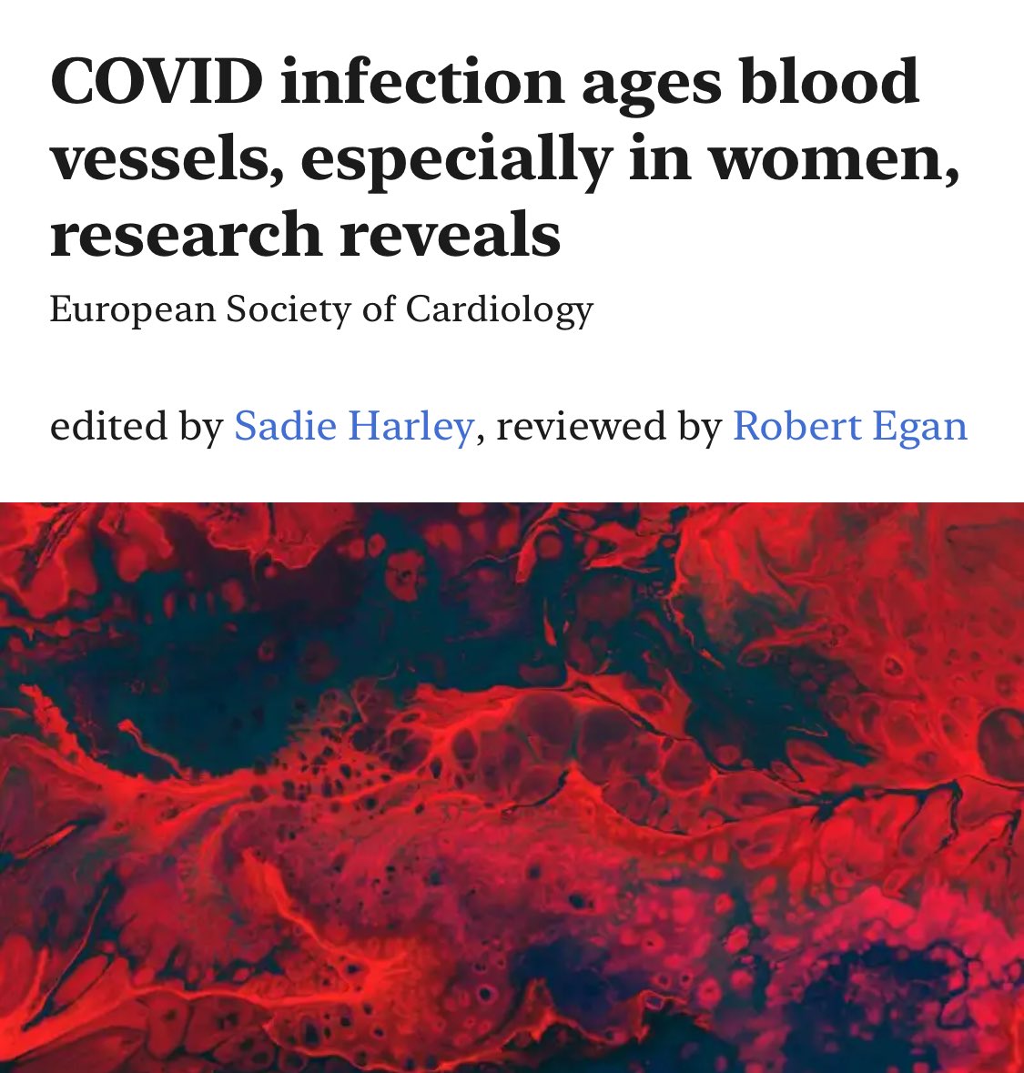 acrossthemersey's tweet image. Research published in the European Heart Journal studying 2,390 people from 16 countries found that SARS2 infections, even mild, likely causes blood vessels to stiffen and age by approx. 5 years, increasing the risk of developing cardiovascular disease, strokes and heart attacks.
