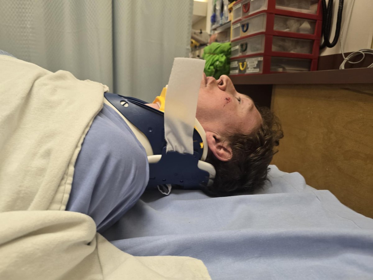 KristopherRett1's tweet photo. This was this morning today ended up in c collar this morning after fainting and injuring my neck  got good care and already home to recover thankfully I only had c collar on 6 hours but I was put on a back board https://t.co/QYnHveYL7z