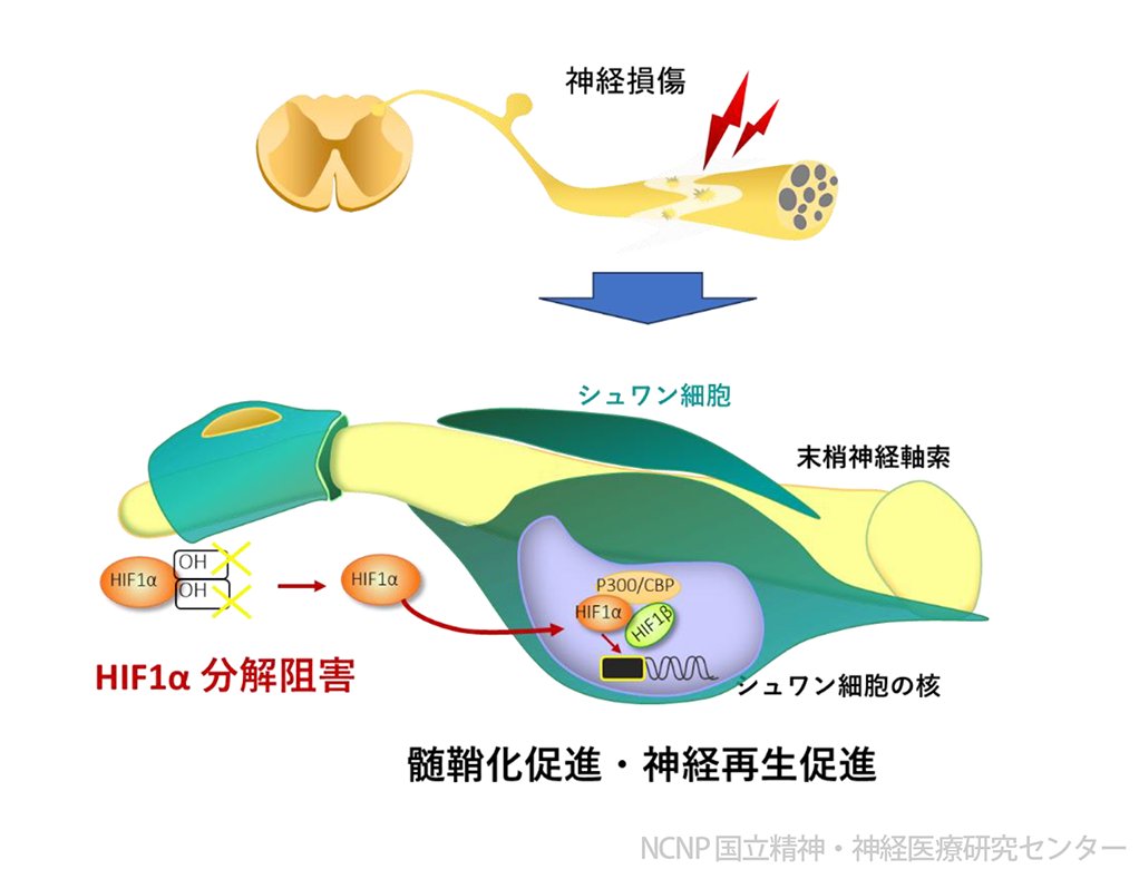 プレスリリース］NCNP 神経研究所  疾病研究第五部、九州大学、早稲田大学の研究グループは、酸素が少ない状態（低酸素環境）が末梢神経損傷後の回復を早めることをモデルマウスにより初めて示しました。  ➡https://t.co/4tVtdWON5j #神経細胞 #末梢神経 #低酸素環境 ...