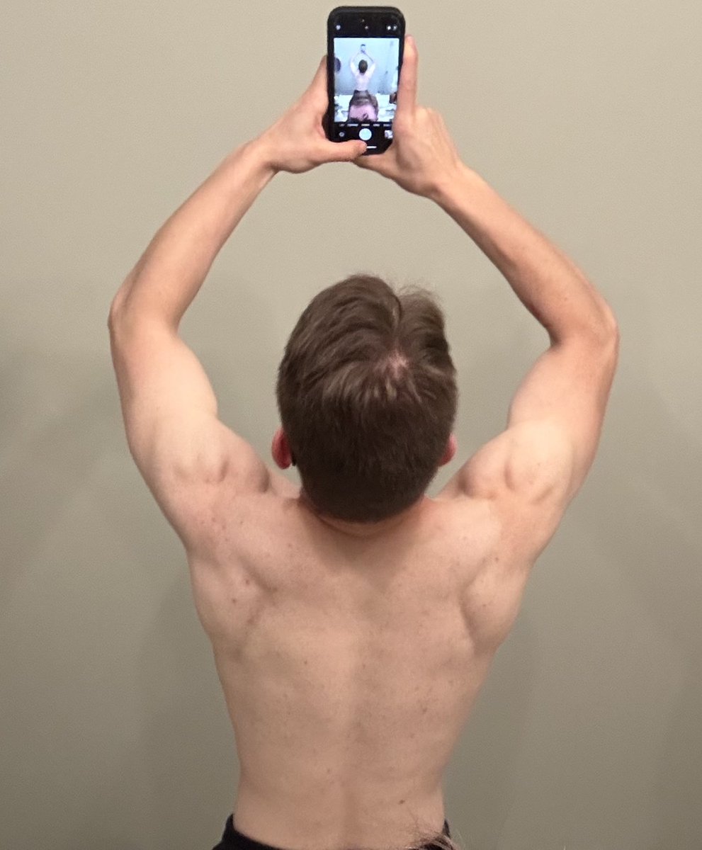 The same back pose, 10 months later 
Oct 2024 - Aug 2025