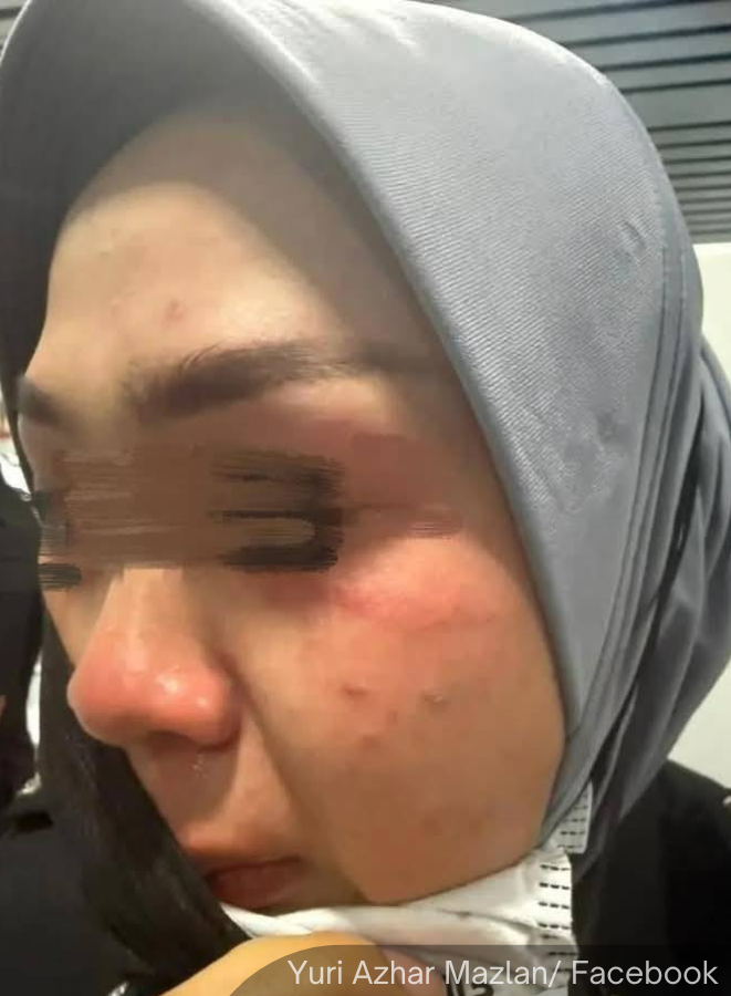 NewsBFM's tweet photo. A 31-year-old Chinese national pleaded guilty to injuring an immigration officer at KLIA last Thursday (Aug 14).

The Sepang Magistrate's Court sentenced Fang Fuyuan to one month in jail and a RM2,000 fine.

🧵1 https://t.co/1uulwaXcfp