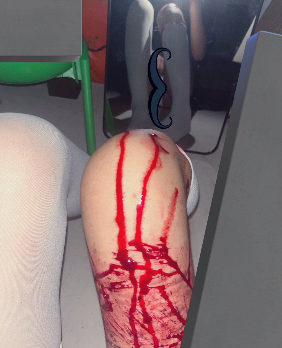 ・ω・ (@killkillovo) on Twitter photo 