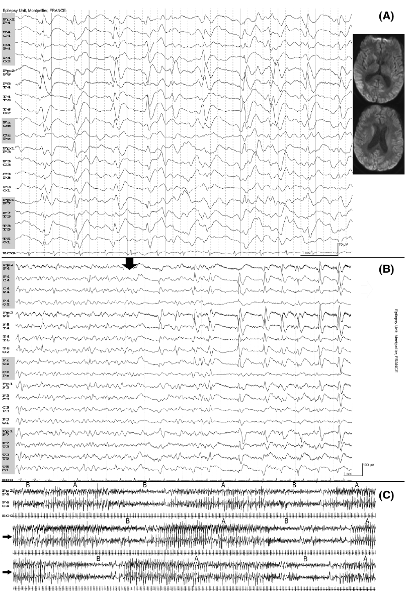 Philippe Gelisse tweet media