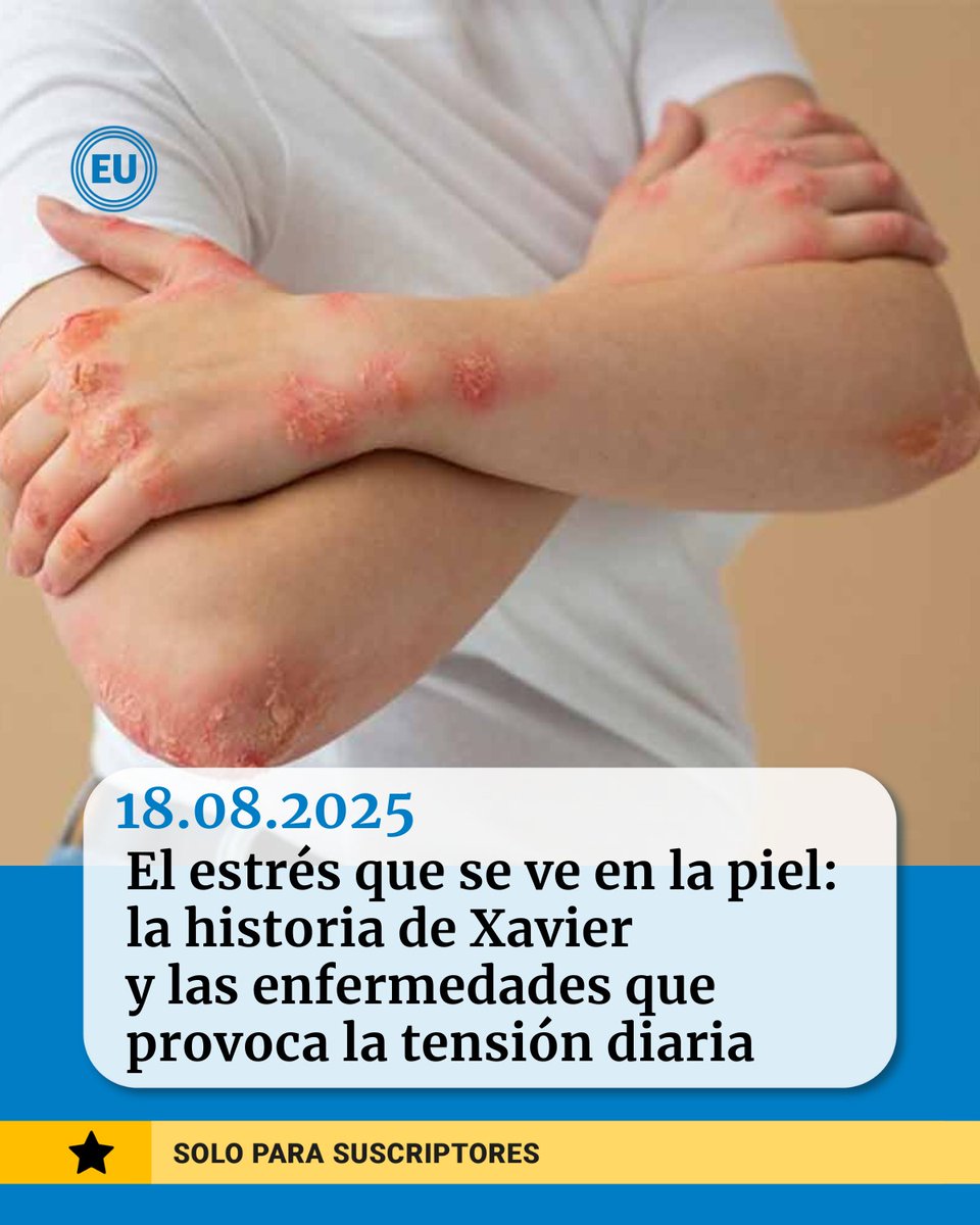 El #estrés que se ve en la #piel: la historia de #Xavier y las enfermedades que provoca la tensión diaria ow.ly/t5X350WHwGm