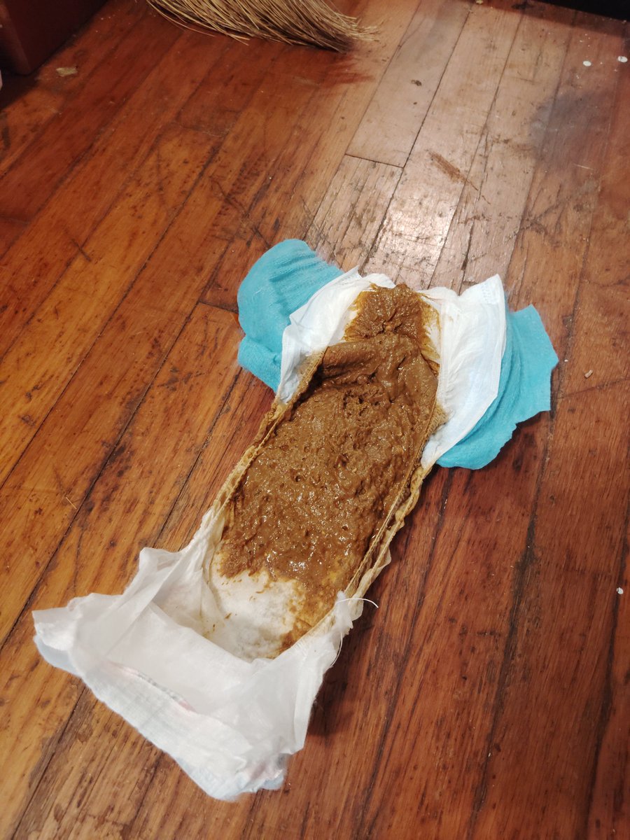 💩Dirty Diaper Diaries 🩲💦