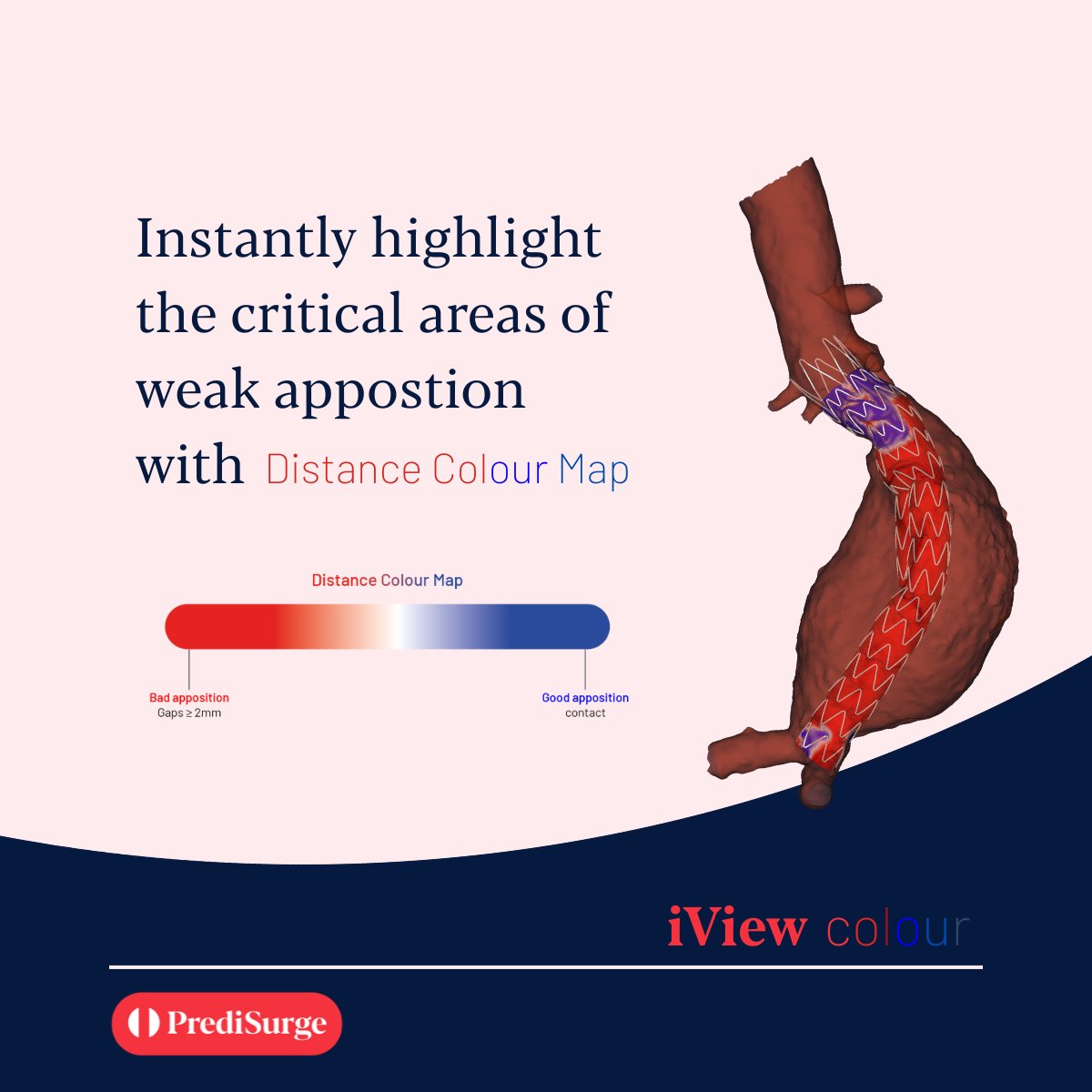 PrediSurge tweet media