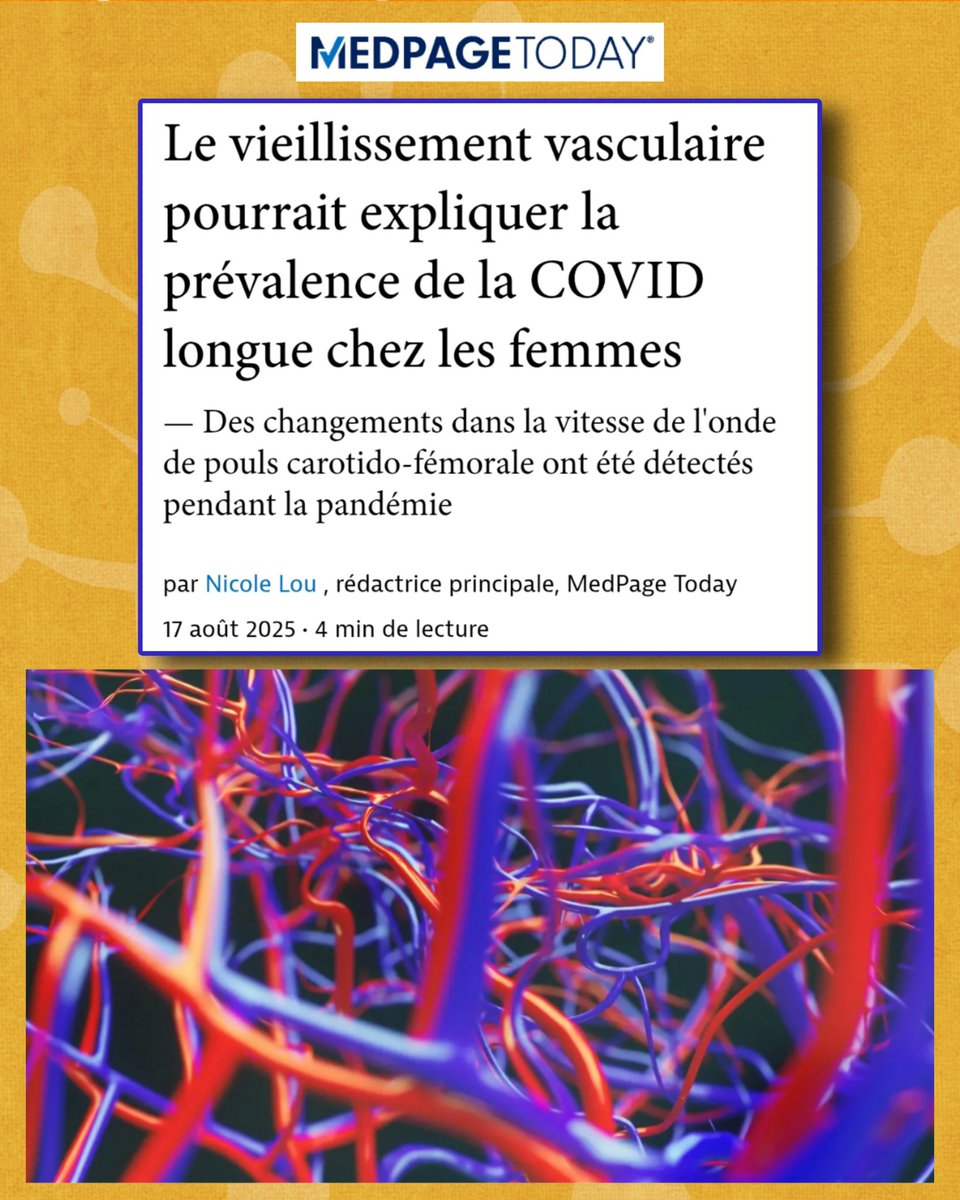 apresj20's tweet image. 🧵🫀« Le vieillissement vasculaire pourrait expliquer la prévalence du #CovidLong chez les femmes » (Medscape).
➡️ L’étude internationale #CARTESIAN montre un vieillissement accéléré des artères après infection, surtout chez les femmes.

#CovidLong #PostCovid