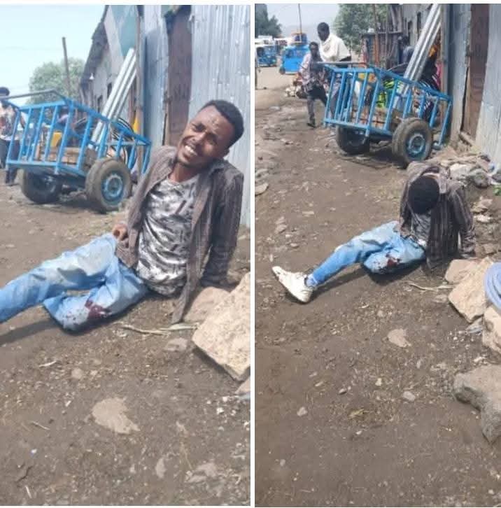 Kindeya Gebrehiwot, PhD, Prof (@profkindeya) on Twitter photo Today, security forces affiliated to the backward group has fired at peacful public at #Mekhoni #Raya #Tigray
and six are heavily wounded due to gunshots. Cruelty at its best! This crime enterprise must be held accountable. <a href="/UNHumanRights/">UN Human Rights</a> <a href="/USEmbassyAddis/">U.S. Embassy Addis</a> <a href="/_AfricanUnion/">African Union</a> <a href="/EUtoAU/">EU Delegation to AU</a> Today, security forces affiliated to the backward group has fired at peacful public at #Mekhoni #Raya #Tigray
and six are heavily wounded due to gunshots. Cruelty at its best! This crime enterprise must be held accountable. <a href="/UNHumanRights/">UN Human Rights</a> <a href="/USEmbassyAddis/">U.S. Embassy Addis</a> <a href="/_AfricanUnion/">African Union</a> <a href="/EUtoAU/">EU Delegation to AU</a>