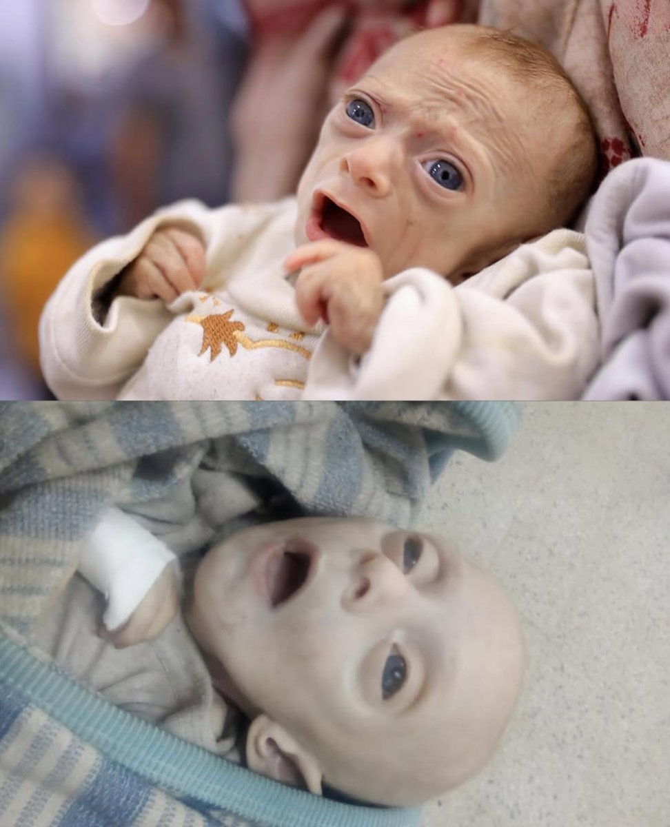 Gazze'de Rafif el-Susi adlı çocuk, açlık ve tedavi eksikliği nedeniyle şehit oldu. 🪽