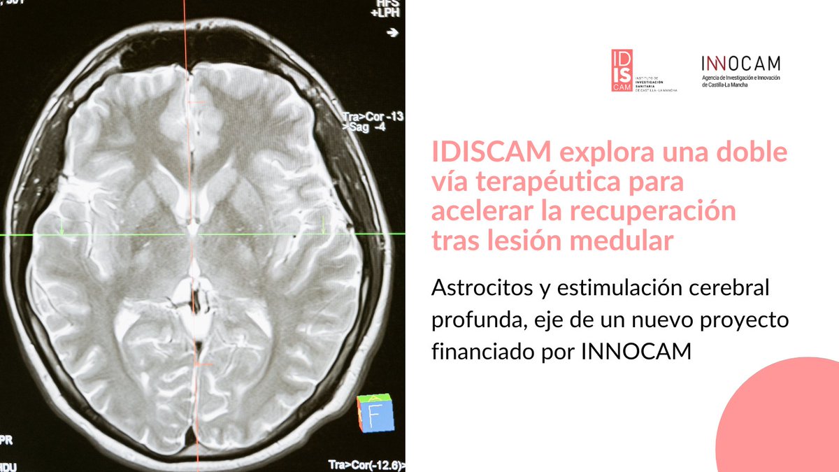 IDISCAM (@idiscam) on Twitter photo Astrocitos y estimulación cerebral profunda como clave para mejorar la recuperación tras una lesión medular 🧠🦽
Juliana Martins da Rosa lidera este proyecto financiado por <a href="/Agencia_INNOCAM/">Agencia de Investigación e Innovación CLM</a> en el <a href="/HNParaplejicos/">H. N. Parapléjicos</a> Astrocitos y estimulación cerebral profunda como clave para mejorar la recuperación tras una lesión medular 🧠🦽
Juliana Martins da Rosa lidera este proyecto financiado por <a href="/Agencia_INNOCAM/">Agencia de Investigación e Innovación CLM</a> en el <a href="/HNParaplejicos/">H. N. Parapléjicos</a>