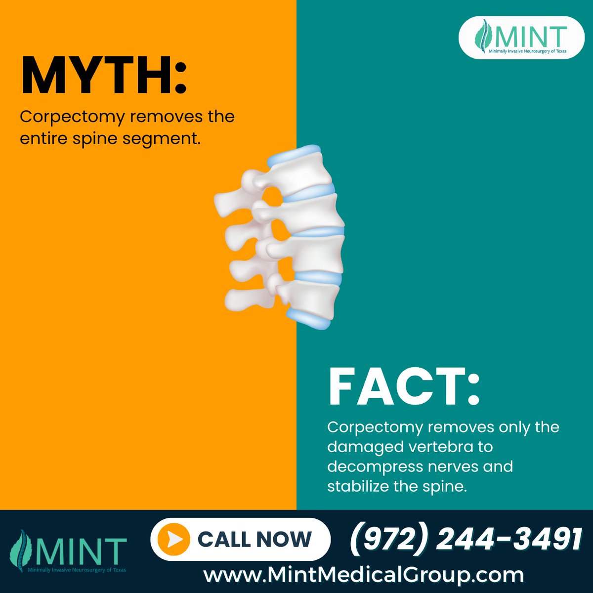 KutzMd's tweet image. Corpectomy isn’t as extreme as it sounds—it’s a precise way to relieve spinal compression and restore stability. Trusted by patients seeking expert care from a spine doctor Frisco TX. 📲 Call (972) 244-3491 today. #spinefacts #FriscoTXspinedoctor #spinecare