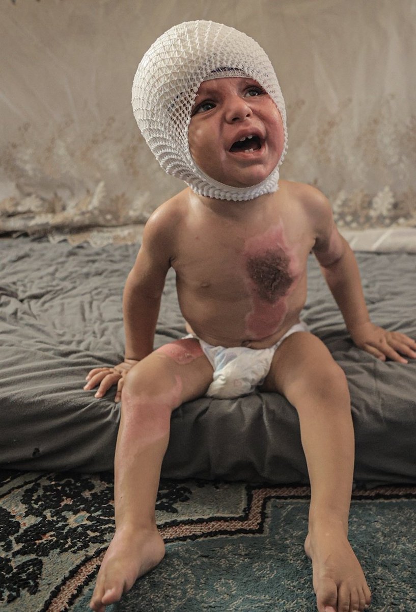 Çocuk katili İsrail çocukları hedef almaya devam ediyor!

 1 yaşındaki Muhammed'in ne suçu vardı?

Gazze'yi unutma unutturma!..