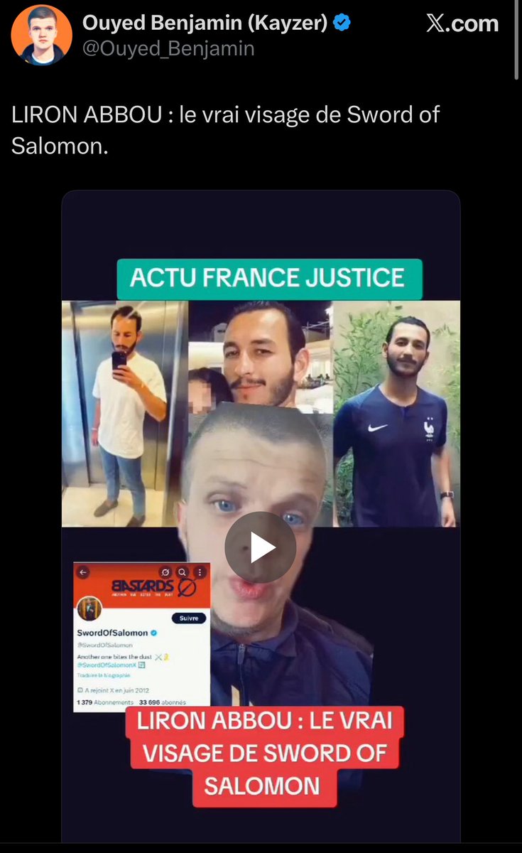 Quand tu as été sorti aux forceps par un obstétricien bourré et que tu as gardé la marque des cuillères lol 

#VanneDeMedecin