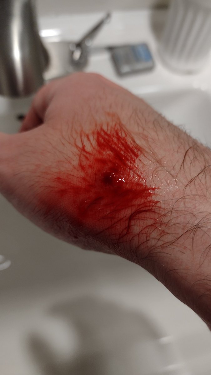 The masculine urge to crave out your warts instead of daintily applying creams and gels