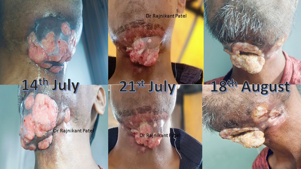 Dr.Rajnikant Patel tweet media