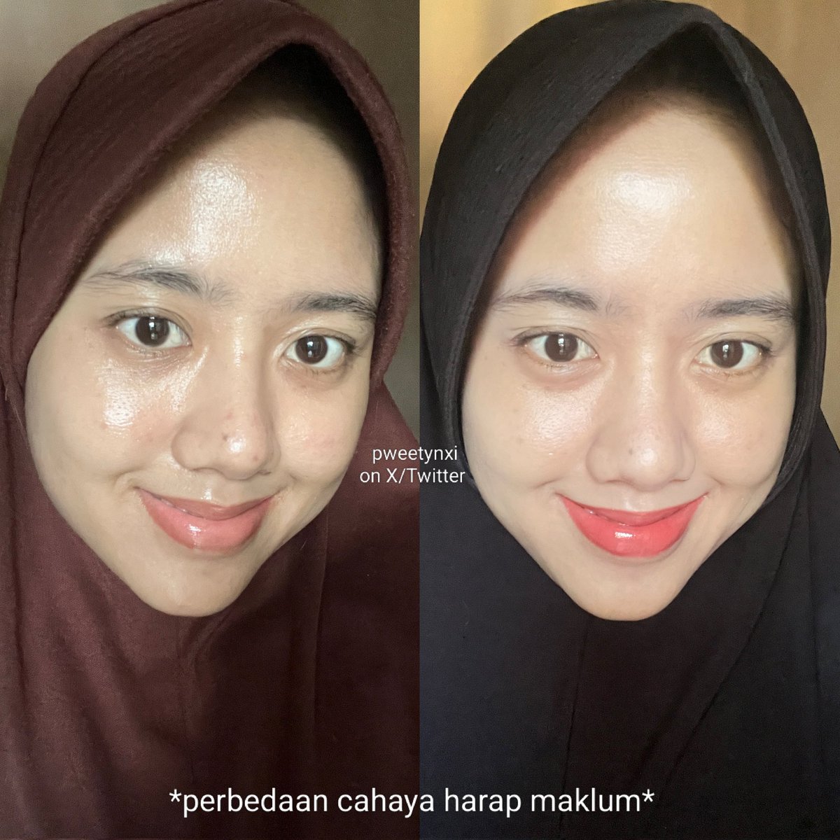 Daripada gonta ganti skincare terus tapi ga ada hasilnya atau malah bikin skin barrier rusak breakout😭

Aku prefer pake produk dan treatment sesuai rekomendasi dokter. Hasilnya jauh lebih keliatan😻🩷