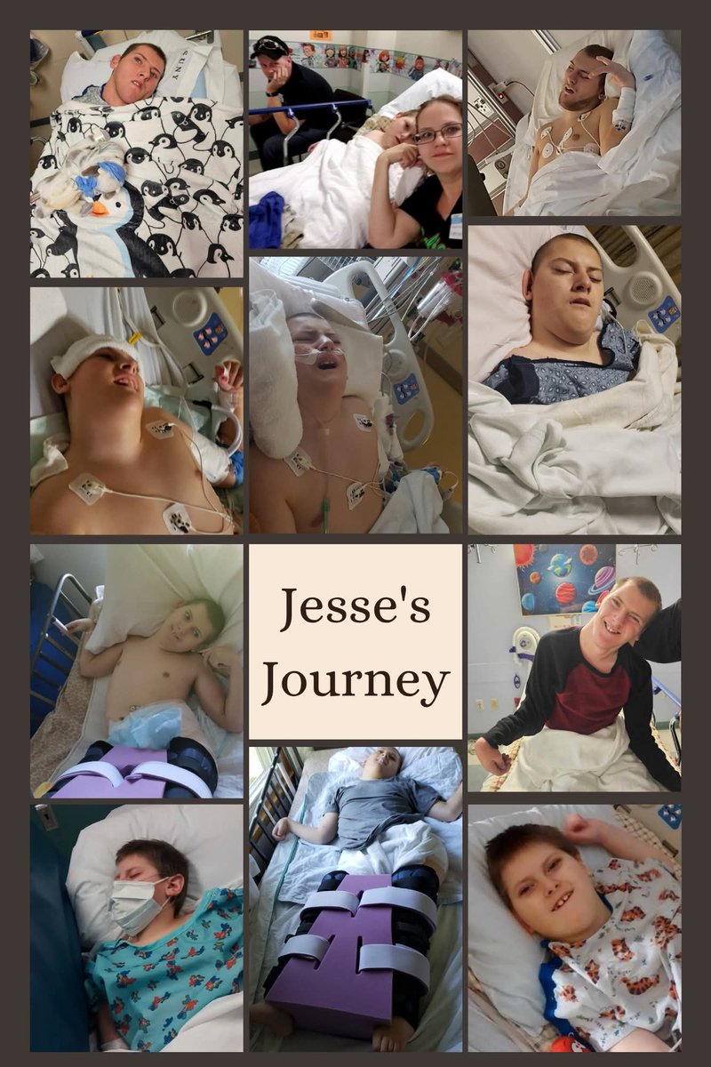 Hey everyone! This is my grandson Jesse's GoFundMe campaign, and it's really touching to see how much he's fought through over the years. If you can, consider donating or sharing this to help him get the wheelchair-accessible van he needs.