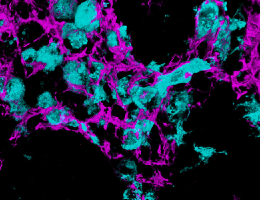 Science Immunology (@sciimmunology) on Twitter photo mRNA-, adenovirus vector-, and protein-based #COVID19 #vaccines have distinct effects on lymph node stromal cell gene expression and function, according to new research in mice. <a href="/SalmiLab/">Research group of Professor Marko Salmi</a>
Learn more in Science #Immunology: scim.ag/4oHFi7Q mRNA-, adenovirus vector-, and protein-based #COVID19 #vaccines have distinct effects on lymph node stromal cell gene expression and function, according to new research in mice. <a href="/SalmiLab/">Research group of Professor Marko Salmi</a>
Learn more in Science #Immunology: scim.ag/4oHFi7Q