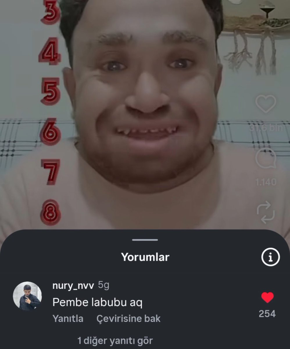 redditboi's tweet photo. https://t.co/UNeIfNA6T5