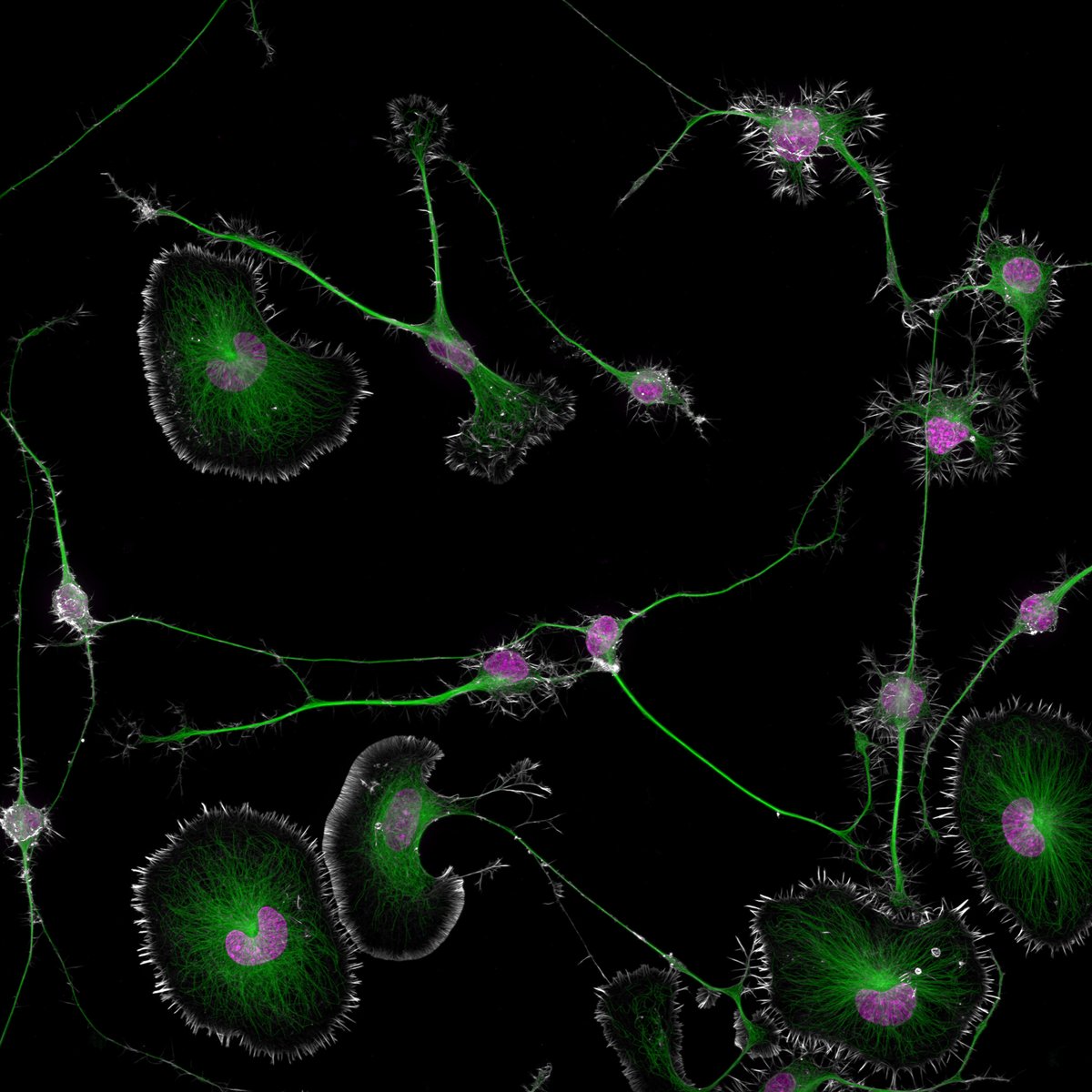 Marine Biological Laboratory (MBL) (@mblscience) on Twitter photo Happy #MicroscopyMonday!
The Nikon Small World Exhibit showcases life's beauty and complexity as seen through the light microscope. 1st place went to Dr. Bruno Cisterna and Dr. Eric Vitriol, who photographed mouse brain tumor cells.
Can you guess the magnification of the lens? Happy #MicroscopyMonday!
The Nikon Small World Exhibit showcases life's beauty and complexity as seen through the light microscope. 1st place went to Dr. Bruno Cisterna and Dr. Eric Vitriol, who photographed mouse brain tumor cells.
Can you guess the magnification of the lens?