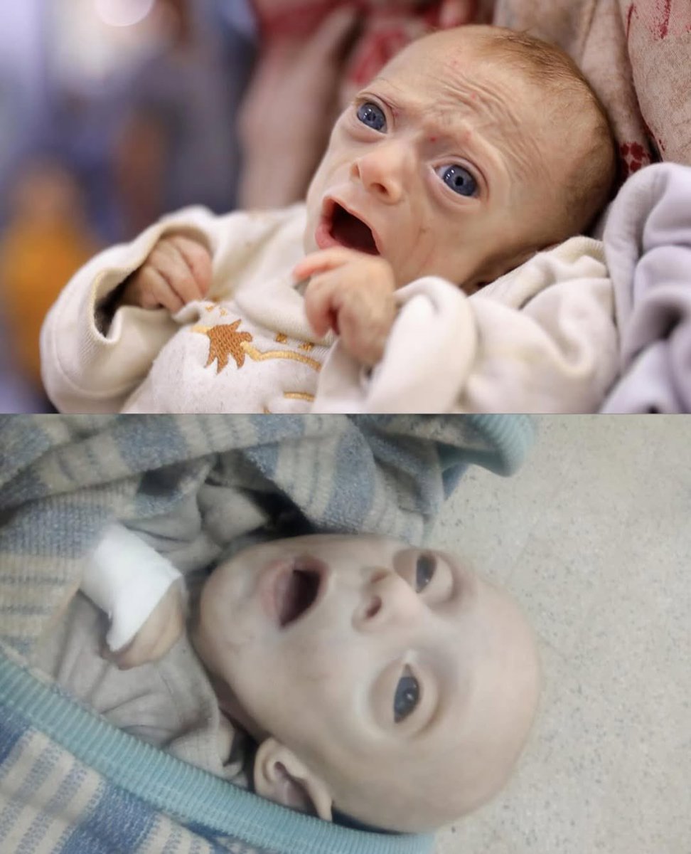 Asifnaz53164600's tweet photo. Malnourished baby Rafif al Sousi has died of hunger due to the ongoing starvation imposed by the cruel Israeli occupation regime! #palastine #Bahawalpur #Israeli #AmericaEurop #allamerican #EuropeNews #allworld #western #Europe #EuropeNews #allworld #gulfnews #imrankhan #palastin https://t.co/e0OcepqS2Y