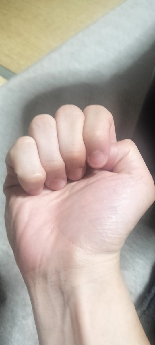 🎸motoki🎸@VARIOUS BOND (@motoki_various) on Twitter photo すごい分かりづらいと思うんやが、左手の小指が右手と比べて内側に向いてるんよねえ
矯正する方法ってあるんかねえ すごい分かりづらいと思うんやが、左手の小指が右手と比べて内側に向いてるんよねえ
矯正する方法ってあるんかねえ