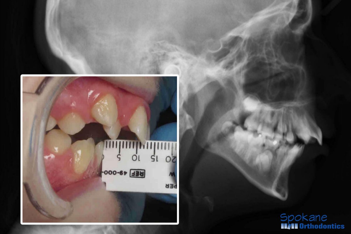 Spokane Orthodontics (@Spokane_Ortho) / Posts / X