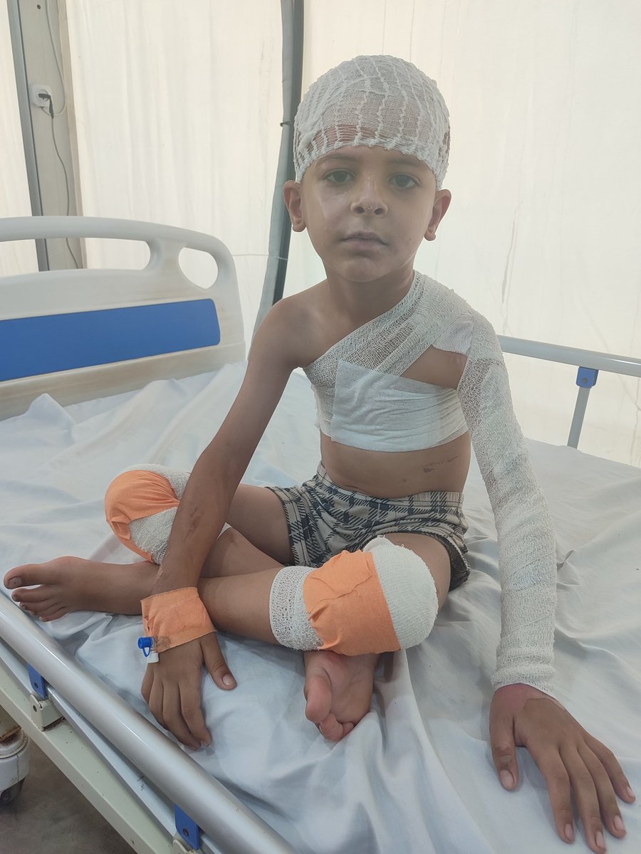 I write these words with a heavy heart with worry and pain…
My child, Mohammed, is still suffering from severe burns across his small body, and I am unable to provide the necessary treatment to save his life.

My family and I live in extremely harsh living conditions. We can