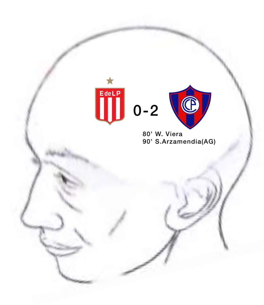x: en qué piensa tanto este boludo?

yo re boludo: