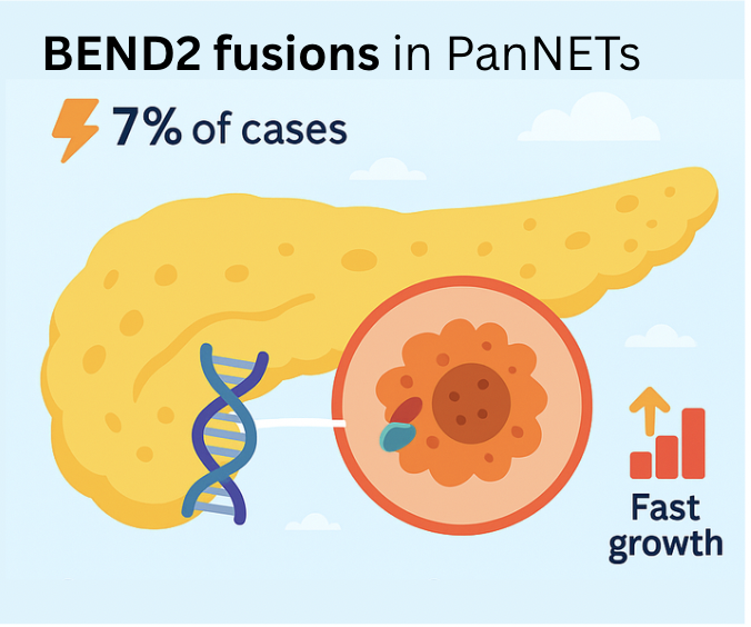 Julie Hallet (@halletjulie) on Twitter photo New marker for NF-PanNETs: BEND2 fusions
by <a href="/PancPathologist/">Aatur Singhi, MD PhD</a>
⚡ 7% of cases
⬇️DFS 13% at 3y
⬇️DSS 25% at 5y
ATRX-DAXX-BEND2🧬in 62% of met PanNETs
Great to add markers to 🧰 in heterogeneous PanNETs! Let's keep 👀 for clinical implications & use
sciencedirect.com/science/articl… New marker for NF-PanNETs: BEND2 fusions
by <a href="/PancPathologist/">Aatur Singhi, MD PhD</a>
⚡ 7% of cases
⬇️DFS 13% at 3y
⬇️DSS 25% at 5y
ATRX-DAXX-BEND2🧬in 62% of met PanNETs
Great to add markers to 🧰 in heterogeneous PanNETs! Let's keep 👀 for clinical implications & use
sciencedirect.com/science/articl…