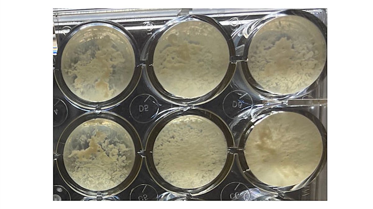 astrobiology's tweet image. Tersicoccus phoenicis Microbes Found In A Spacecraft Clean Room Exhibits Dormancy
astrobiology.com/2025/08/tersic…  #astrobiology #microbiology #PlanetaryProtection