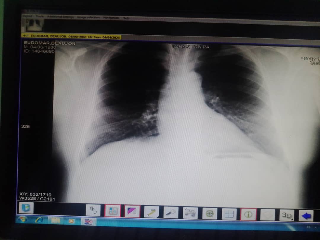 Angnomarb's tweet photo. hola @grok que diagnostico puedes ver en la radiografía https://t.co/UKVIIE2L3M