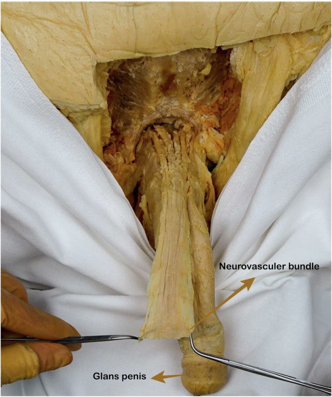 Glans necrosis following penile procedures: a systematic review of etiology, frequency, and management 👉 rdcu.be/eBfJC

<a href="/berkhazir/">Berk Hazır</a> <a href="/amerseburger/">Axel S. Merseburger</a> <a href="/OsmonovDr/">Prof. Dr. Daniar Osmonov, FECSM</a>