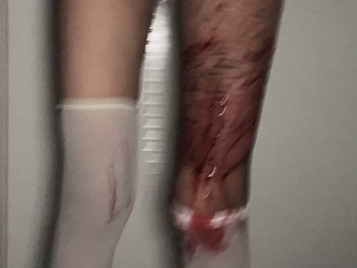 ・ω・ (@killkillovo) on Twitter photo 