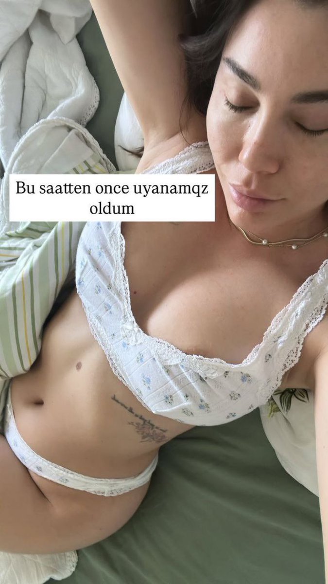 🇦🇿