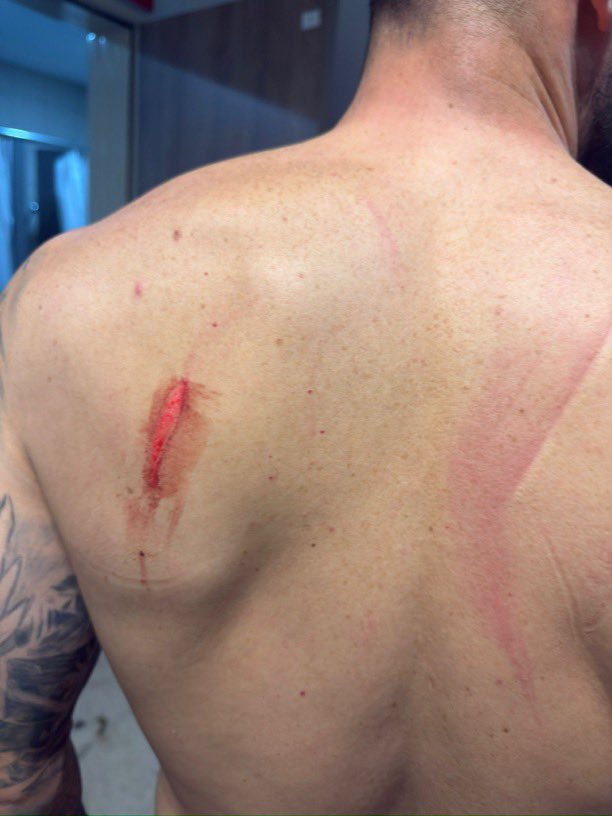 🔥 #SonDakika | Erzurumspor Kongre Üyesi Orkun Çizmeli paylaştı:

“Barış güvercinlerine bakın! AMED'in stadında futbolcularımıza yapılan saldırının fotoğrafları!

Kesici aletlerle oyuncularımıza kimler saldırdı, sorumluları bulun.”