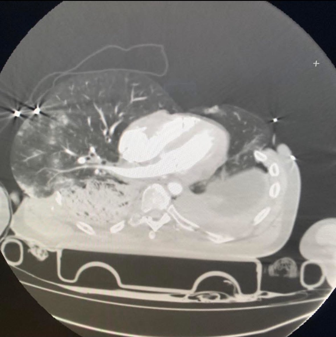 This very impressive CT is apparently circulating online.

Does anyone know anything about it? From a paper? Known story?